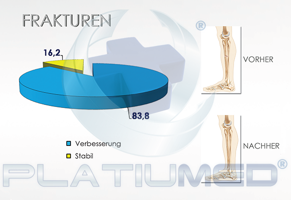 frakturen