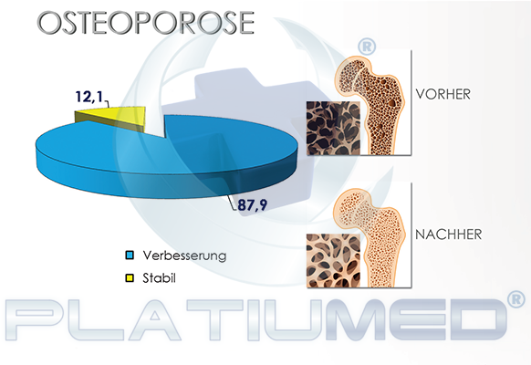 osteoporose