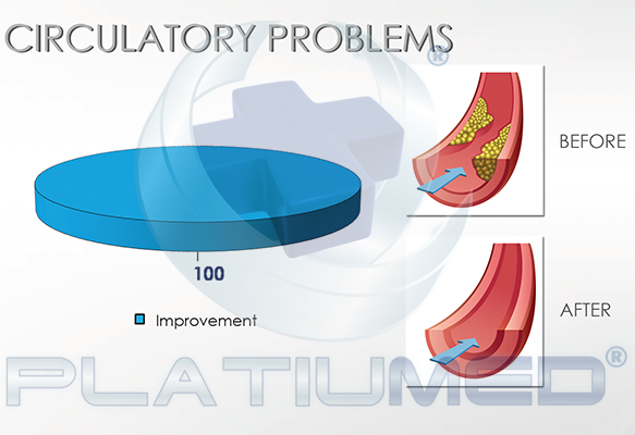 circulatory problems