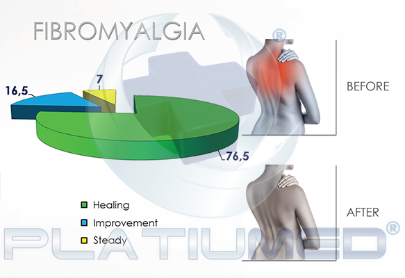 fibromyalgia