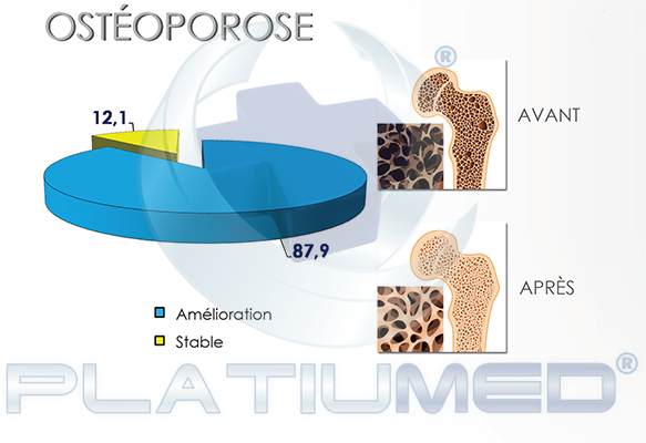 osteoporose