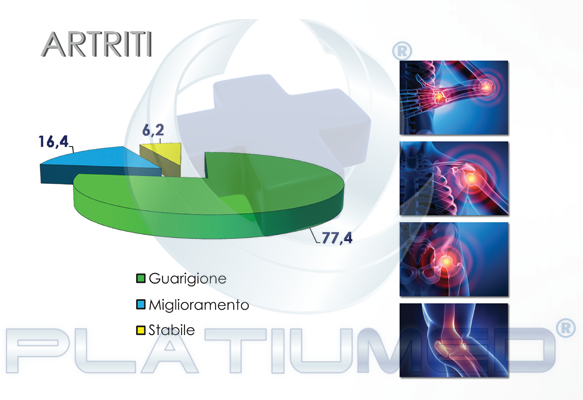 artrite