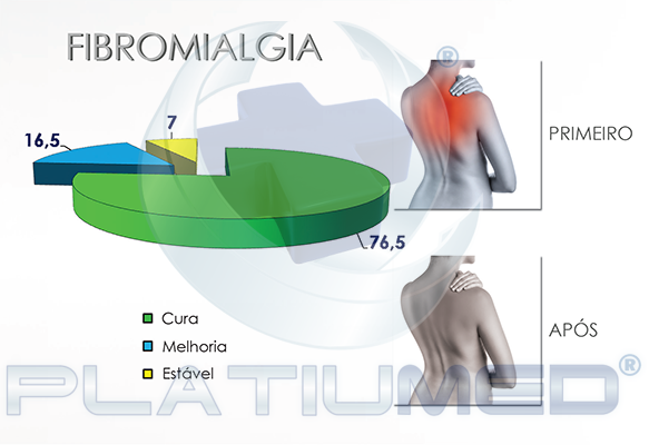 fibromialgia