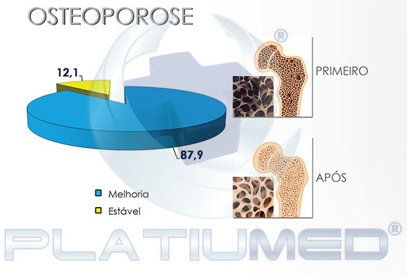 osteoporose