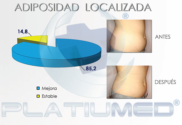 adiposidad localizada