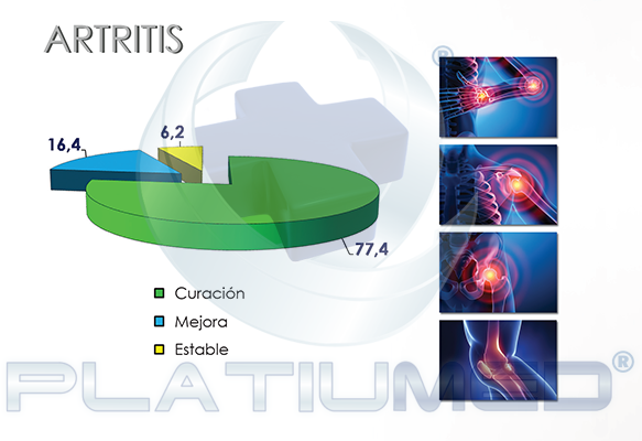 artritis