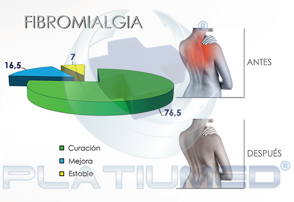 fibromialgia