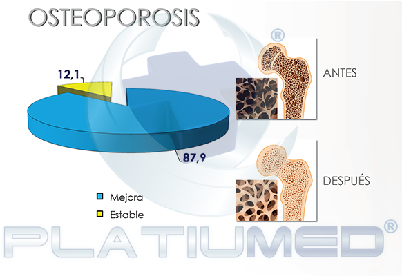 osteoporosis