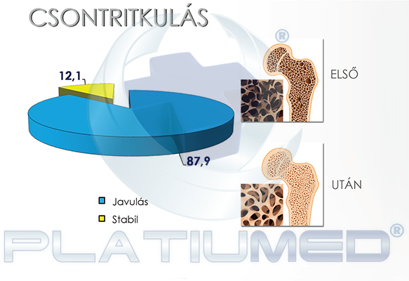 csontrikulas