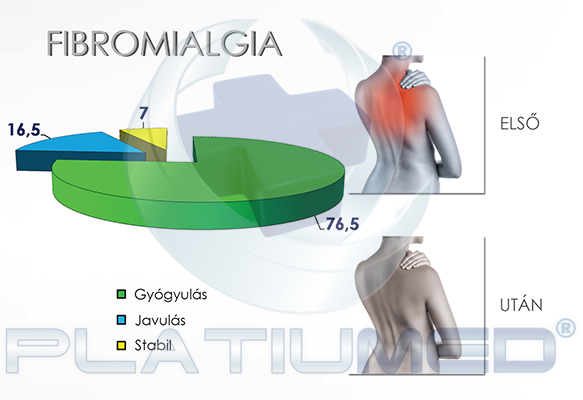 fibromialgia